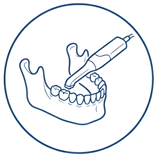 Scanner intra-oral